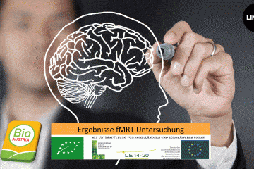 Plakat Ergebnis fMRT Untersuchung